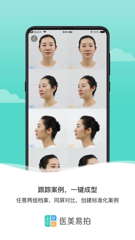 医美易拍app